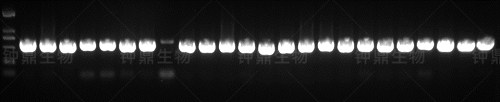 Total RNA 电泳图
