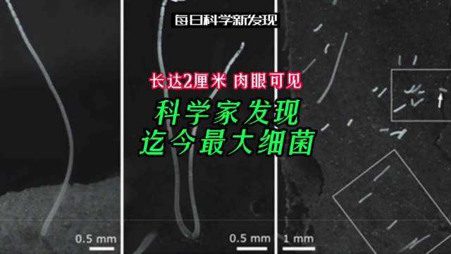 细菌