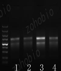 Total RNA 琼脂糖凝胶电泳成像