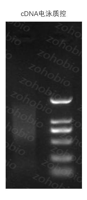 ds cDNA 富集琼脂糖凝胶电泳成像