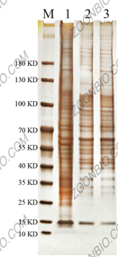 SDS-PAGE检测分析图