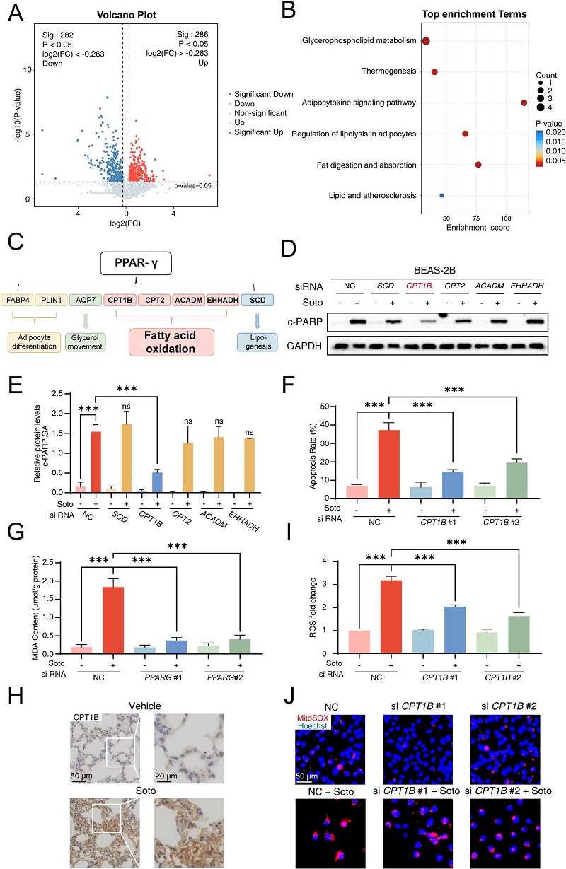CPT1B介导线粒体脂代谢紊乱与ROS爆发