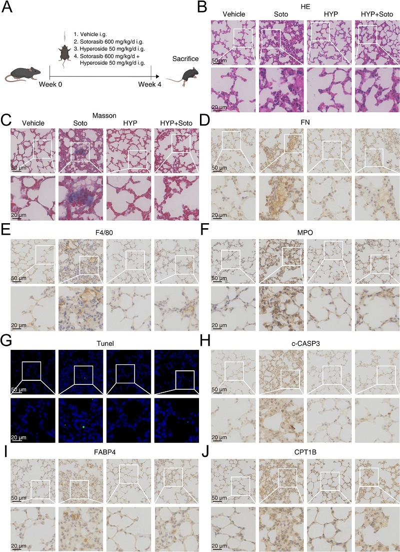 干预策略——FABP4抑制剂金丝桃苷有效缓解肺毒性