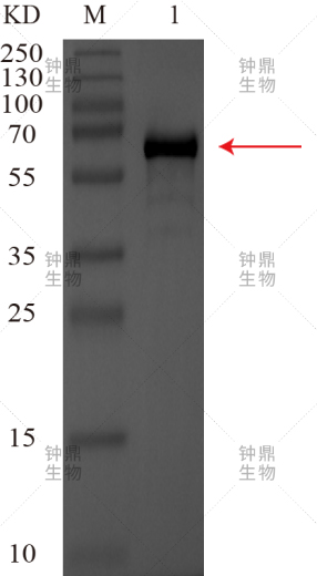 蛋白Western Blot鉴定分析