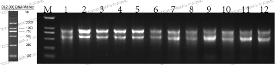 Total RNA 电泳图