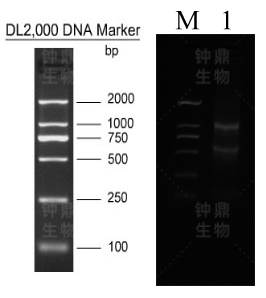 Total RNA 电泳图