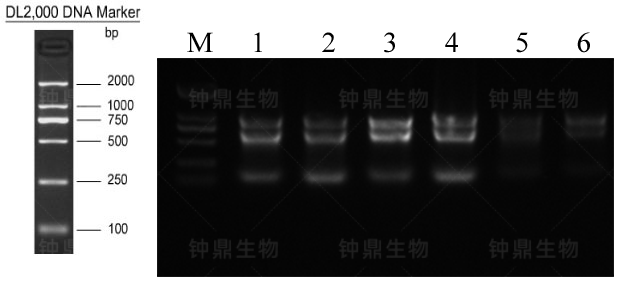 Total RNA 电泳图