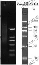 mRNA 分离结果