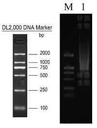 mRNA 分离结果