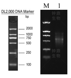 Total RNA 电泳图