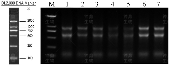 Total RNA 电泳图